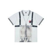 Polo X-Ray